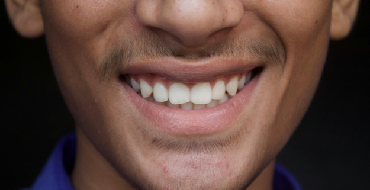 Man Smiling